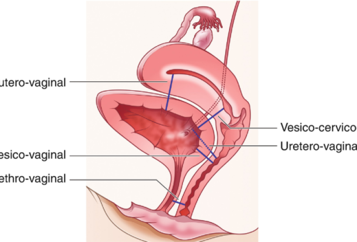 Y25-M07-B-UR-CN1-V3_20250725_v1